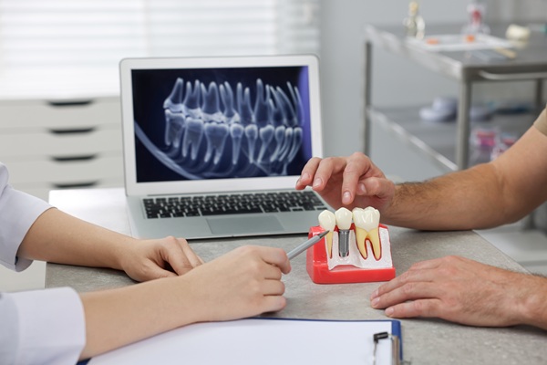 Signs You May Have Damaged Dental Crowns