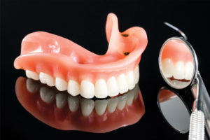 Implant Overdenture