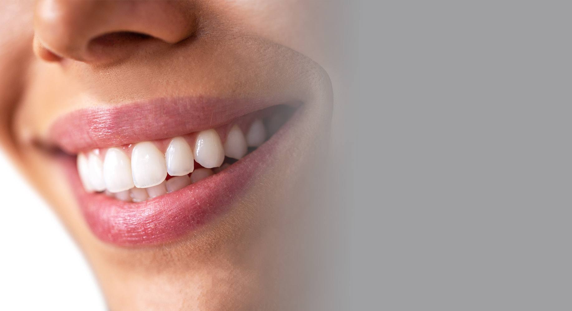 Veneers and Smile Design